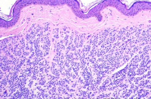 term image