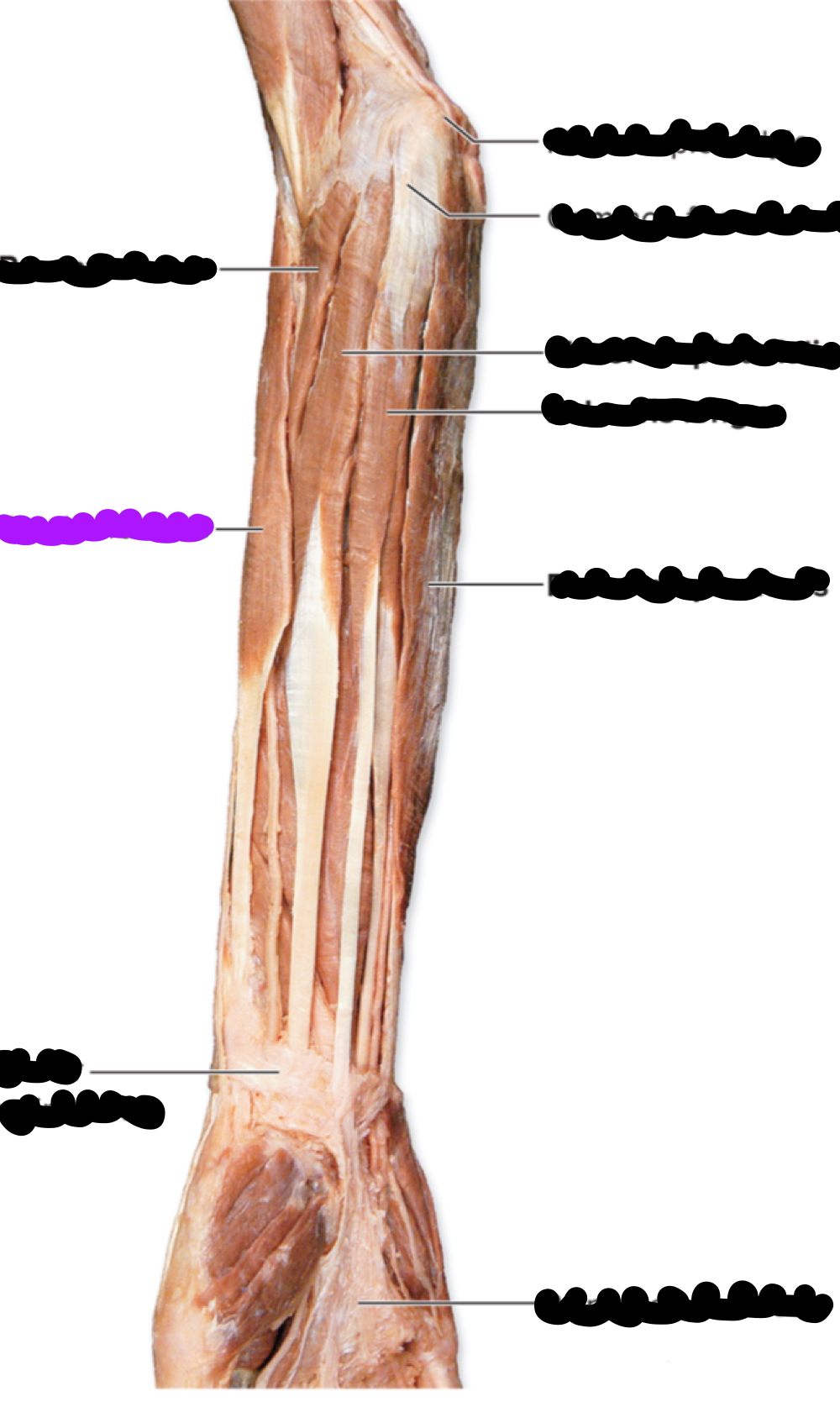 <p>Function?</p>