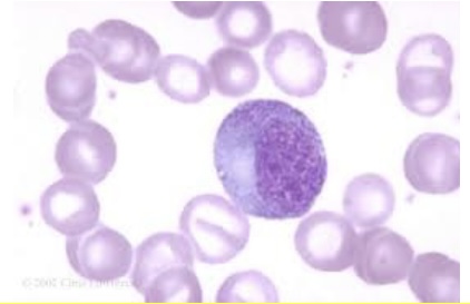 <p><span style="font-family: Helvetica; font-size: 12px;">Which of the following is TRUE regarding this myelocytic development stage?</span></p><p><span style="font-family: Helvetica; font-size: 12px;">a. This is the stage in which the cell will be identified as a neutrophil, basophil, or eosinophil</span></p><p><span style="font-family: Helvetica; font-size: 12px;">b. This stage is not able to divide</span></p><p><span style="font-family: Helvetica; font-size: 12px;">c.This is the metamyelocyte stage</span></p><p><span style="font-family: Helvetica; font-size: 12px;">d. This stage has only primary granules</span></p>