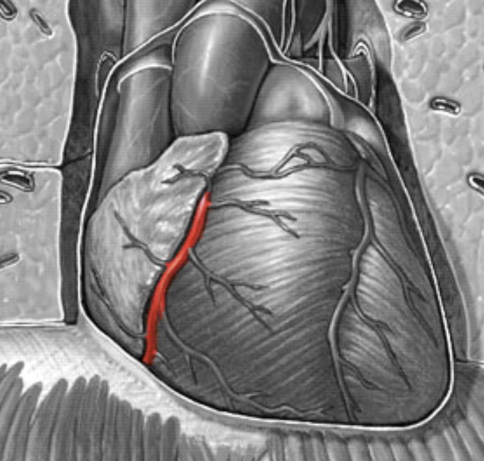 <p>Which heart circulation:</p><ul><li><p>Feeds off the aorta, lies in the <u>right</u> AV sulcus</p></li></ul><p></p>