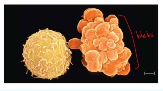 <p>process of apoptosis</p>