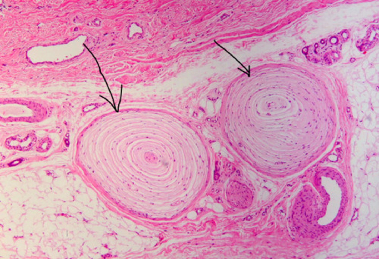 <p>Pacinian Corpuscle (Lamellated corpuscle)</p>