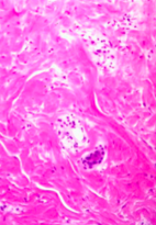 <p>Which connective tissue is this?</p>