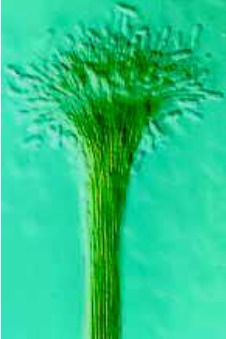 <p>conidioma asexual</p>