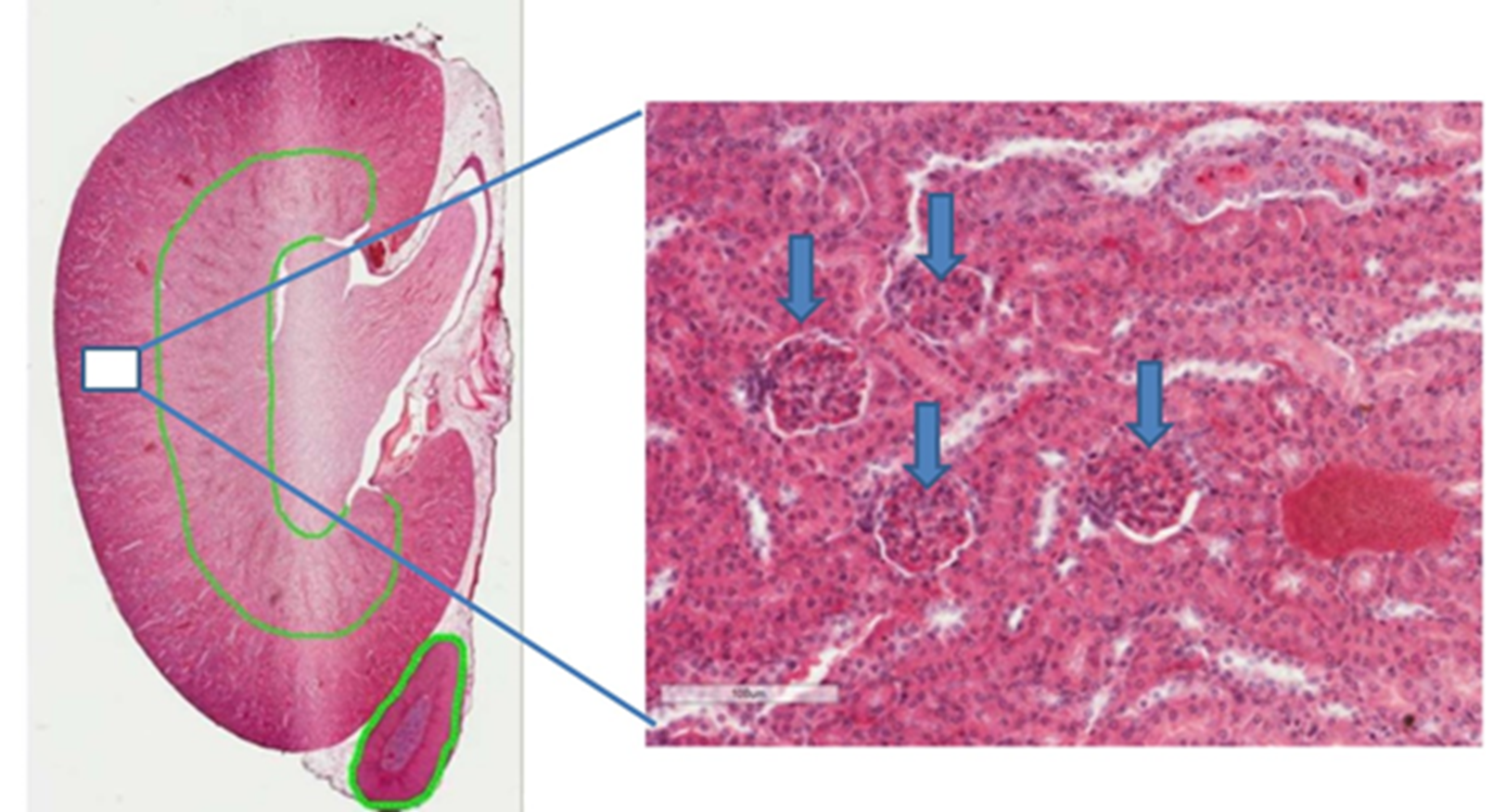 <p>What is this structure located in the kidney?</p>