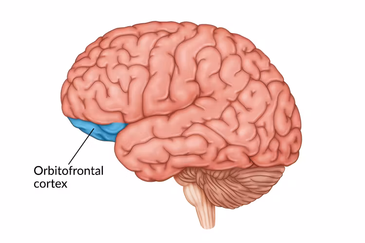 <p>unilateral lesion to orbitofrontal lobe causes _____ syndrome which is low motivation reduced insight reduced impulse control but they exhibit no difficulty with card sorting tasks, however bilateral lesion causes complete lost motivation and no initiation </p>