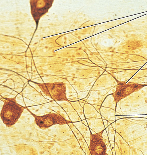 <p>What tissue type does this image depict?</p>