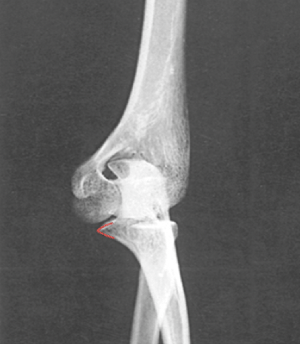 <p>What structure is highlighted?</p>