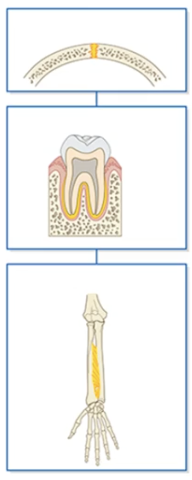 <p>-2 bits of bone united by a sheet of dense connective tissue </p><p></p><p>Suture joint: Located in the skull, and hold skull bone together </p><p></p><p>Gomphosis joint:The joint that holds the tooth into the tooth socket </p><p></p><p>Syndesmosis joint: The joint tat holds together 2 bits of bone that are more further away such as the forearm. also called interosseous membrane/ligament</p>