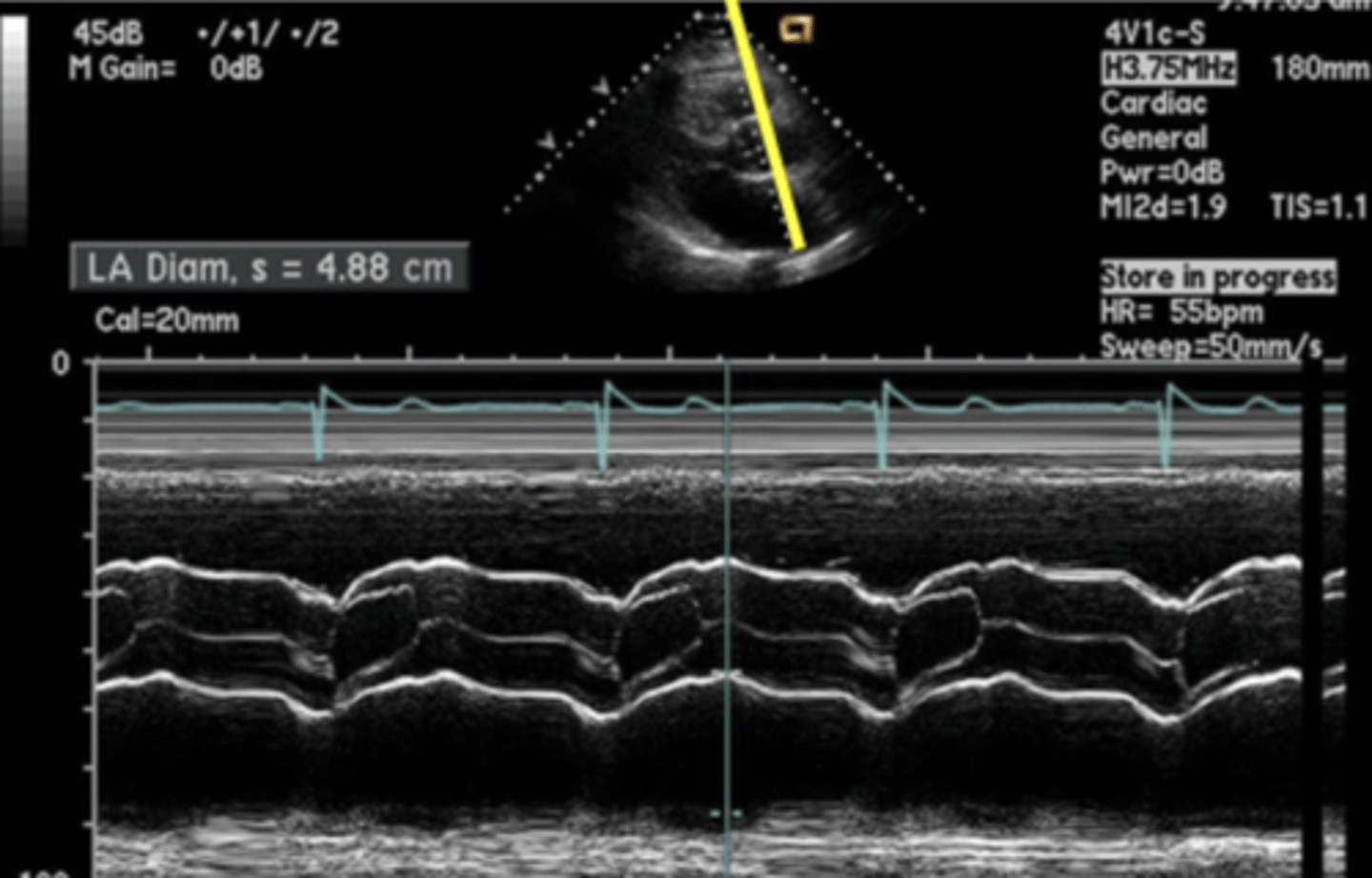 <p>Single sound beam</p><p>Signal amplitude information is converted to dot brightness</p>