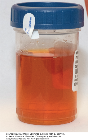 <p>-Red color</p><p>-Red Supernatant</p>