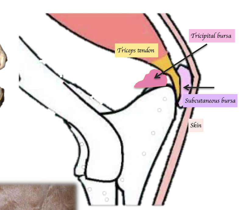 <p>Tricpital bursa - Between tendon and olecranon </p><p>Subcutaneous bursa - Between skin and tendon of insertion of triceps </p>