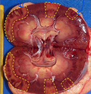 <p>What has occurred in the areas highlighted?</p>