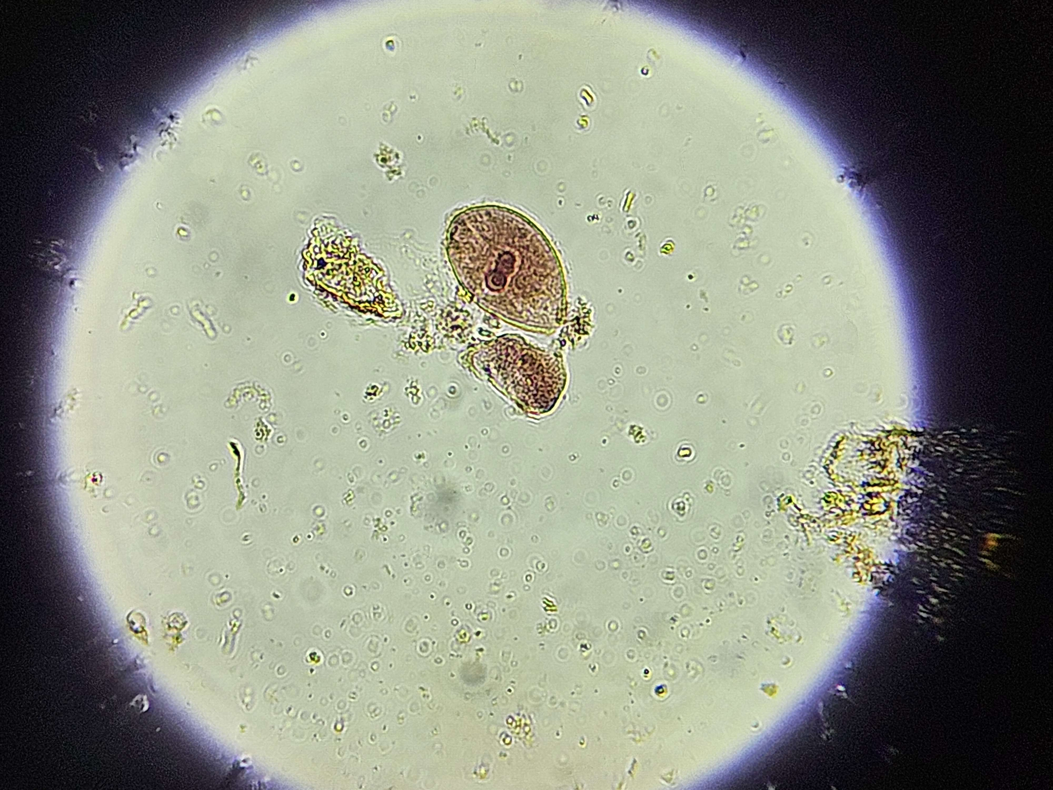 <p><span data-name="microscope" data-type="emoji">🔬</span><span data-name="petri_dish" data-type="emoji">🧫</span><strong><span> </span>Na podstawie zdjęcia preparatu:</strong></p><p></p><ul><li><p><span data-name="book" data-type="emoji">📖</span><span> </span>rozpoznaj gatunek pasożyta;</p></li></ul><p></p><ul><li><p><span data-name="recycle" data-type="emoji">♻</span><span> </span>rozpoznaj wszystkie formy rozwojowe;</p></li></ul><p></p><ul><li><p><span data-name="microbe" data-type="emoji">🦠</span><span> </span>wskaż organelle i cechy charakterystyczne dla danego gatunku;</p></li></ul><p></p><ul><li><p><span data-name="mask" data-type="emoji">😷</span><span> </span>nazwij chorobę, którą pasożyt wywołuje.</p></li></ul><p></p>