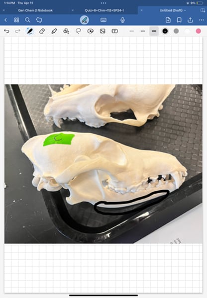 <p>lower jaw bone</p>