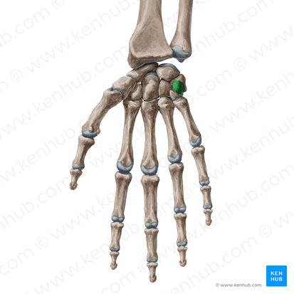 <p>What bone is this?</p>