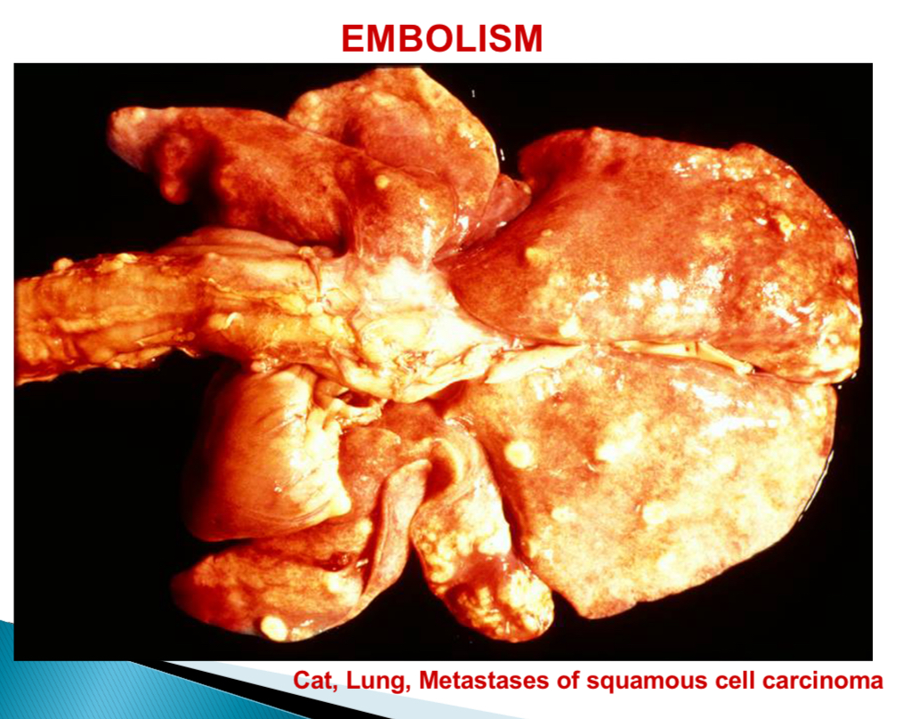 <p>Neoplasm of keratinocytes </p>
