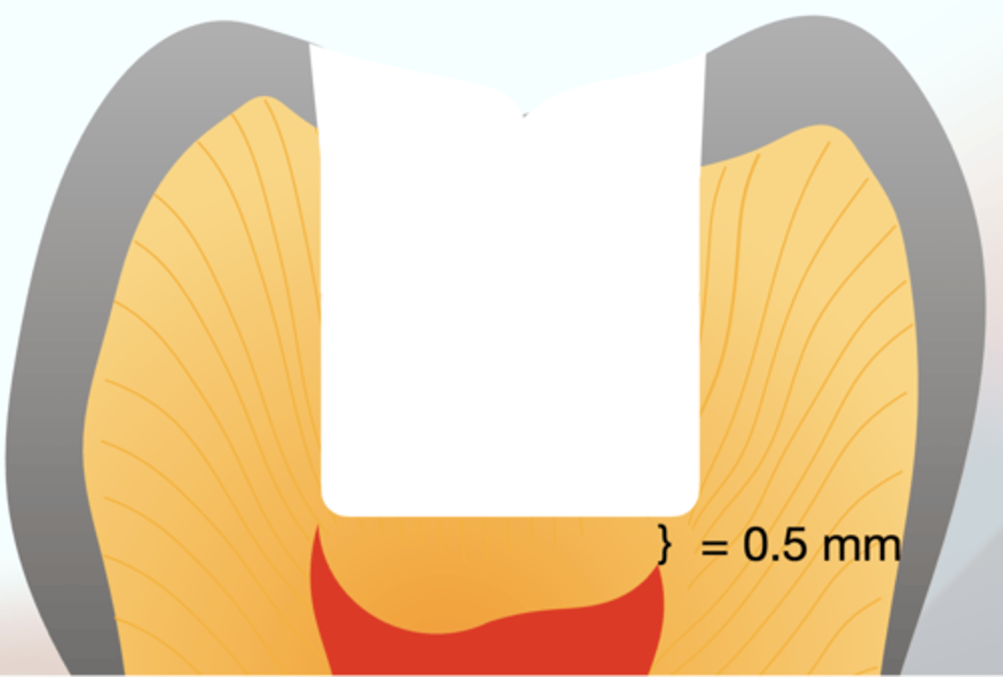 <p>0.5 mm of dentin</p>