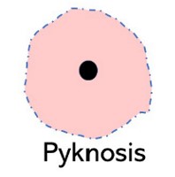 <p>Pyknosis </p>