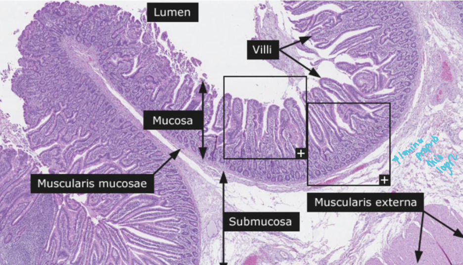 From looking at this picture of a section of the small intestine. 

What four important structures can you see? 