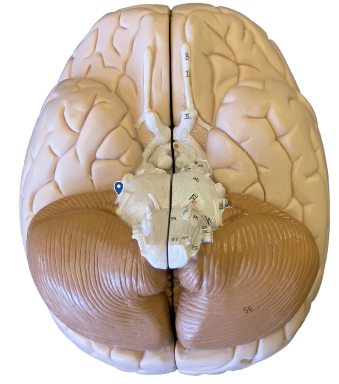 <p>What cranial nerve is the arrow pointing to?</p>