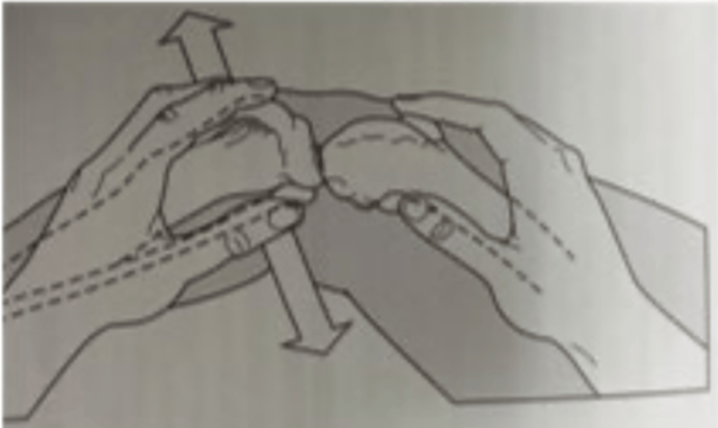 <p>what test is being performed? what is evaluated?</p>