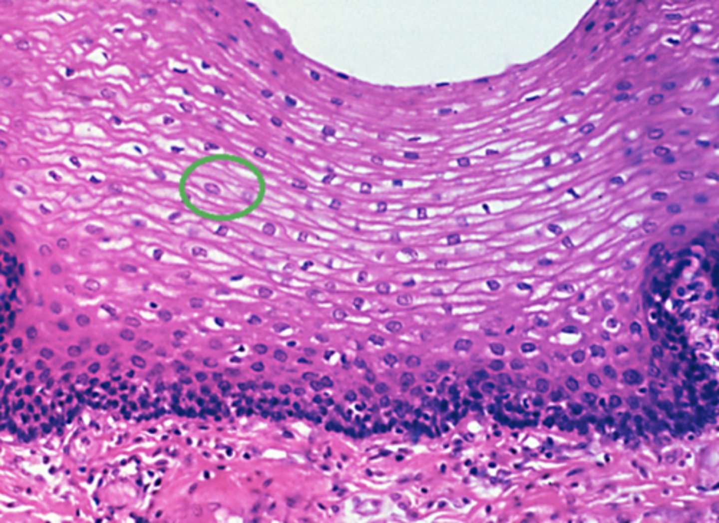 <p>Which of the four major tissue types is presented in the following image of the esophagus: (again, just name one of the four major tissue types, we don't need subtypes)</p>