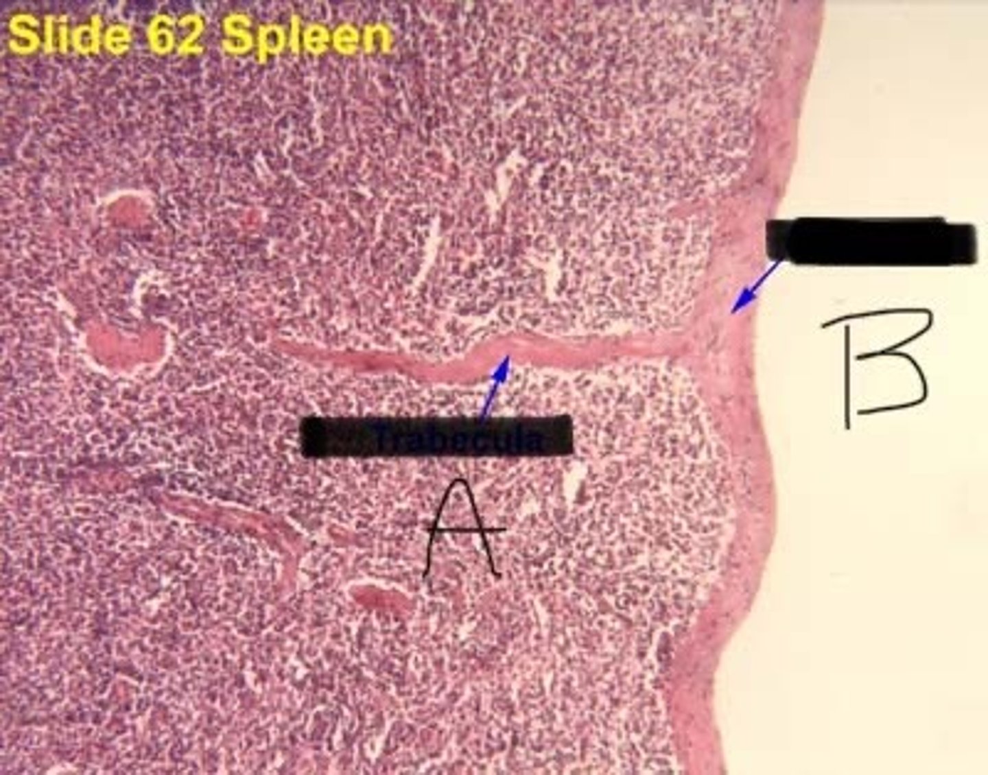 <p>A</p>