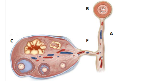 <p>label a,b,c,f</p>