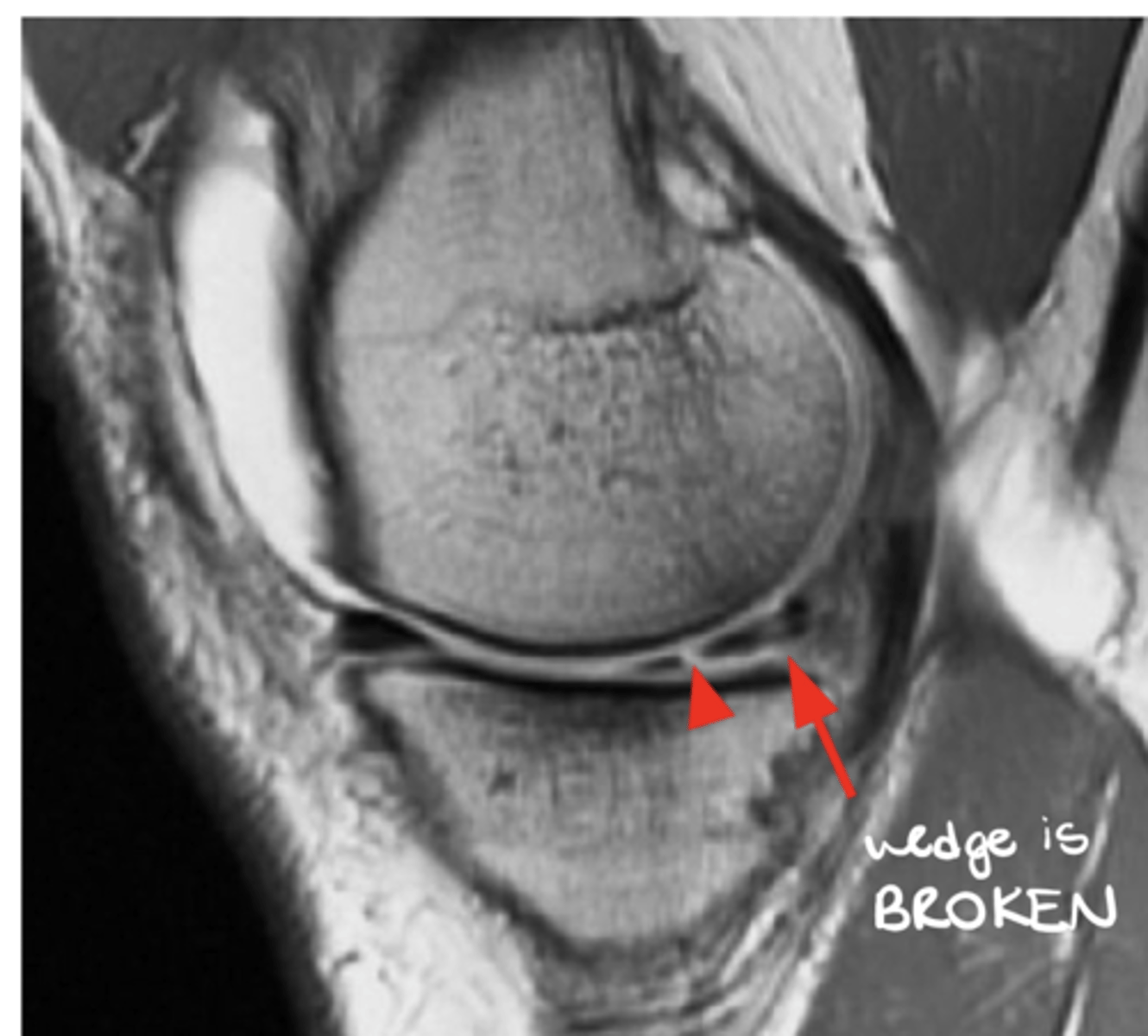 <p>Define the pathology.</p>