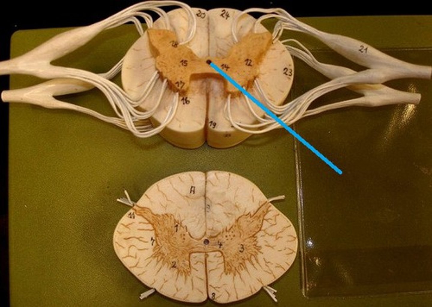 <p>center of spinal cord which contains cerebrospinal fluid</p>