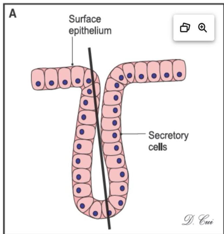 <p>What type of gland is this?</p>