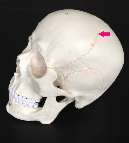 <p>Identify the suture.</p>