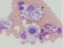 <p>Body cavity effusions</p><p>What is this?</p><p>DX?</p>