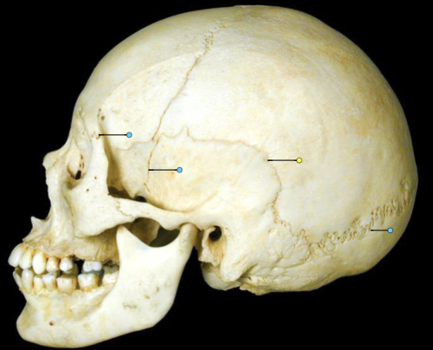 knowt flashcard image