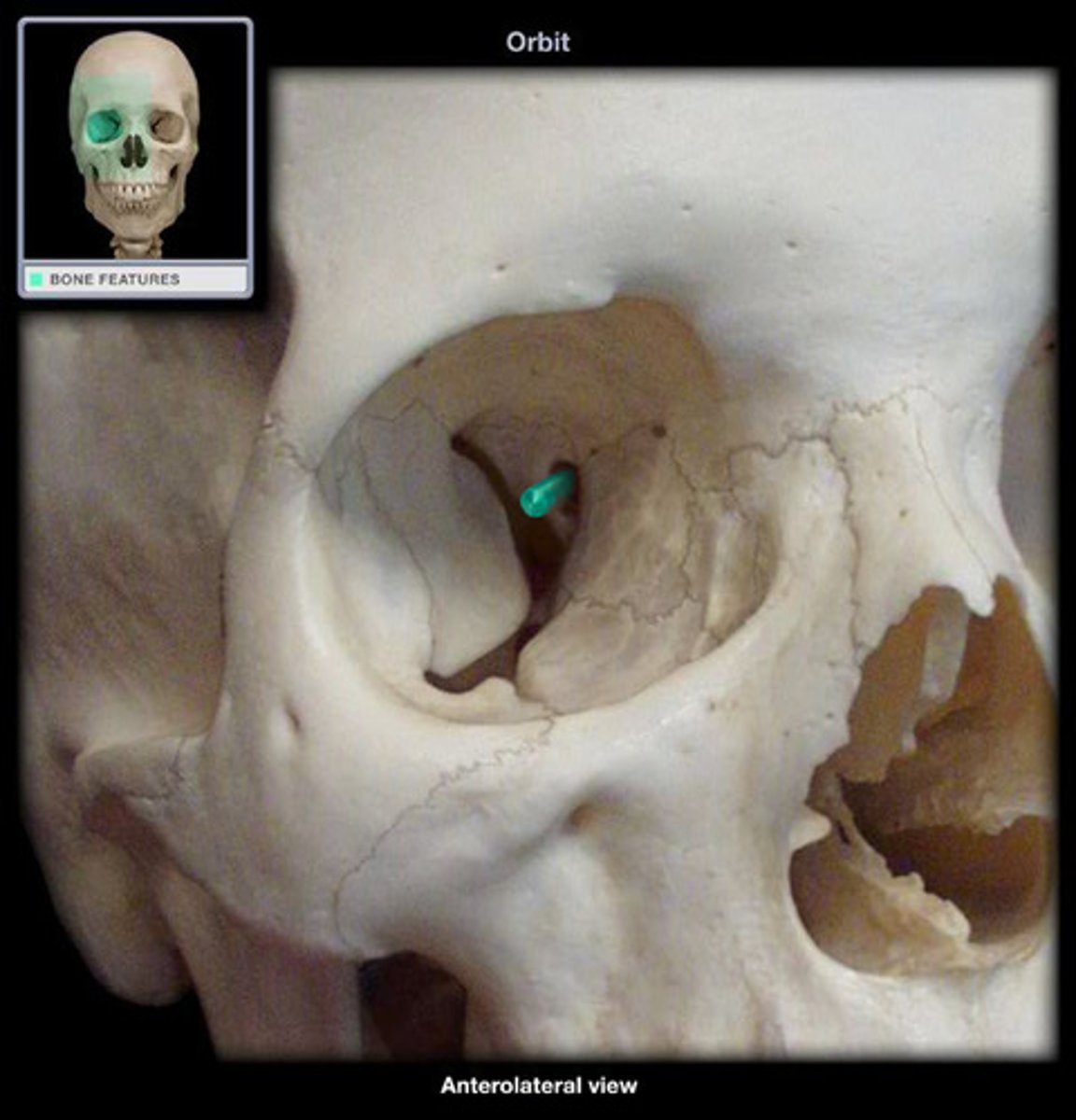 <p>is through the lesser wing of the sphenoid bone</p>