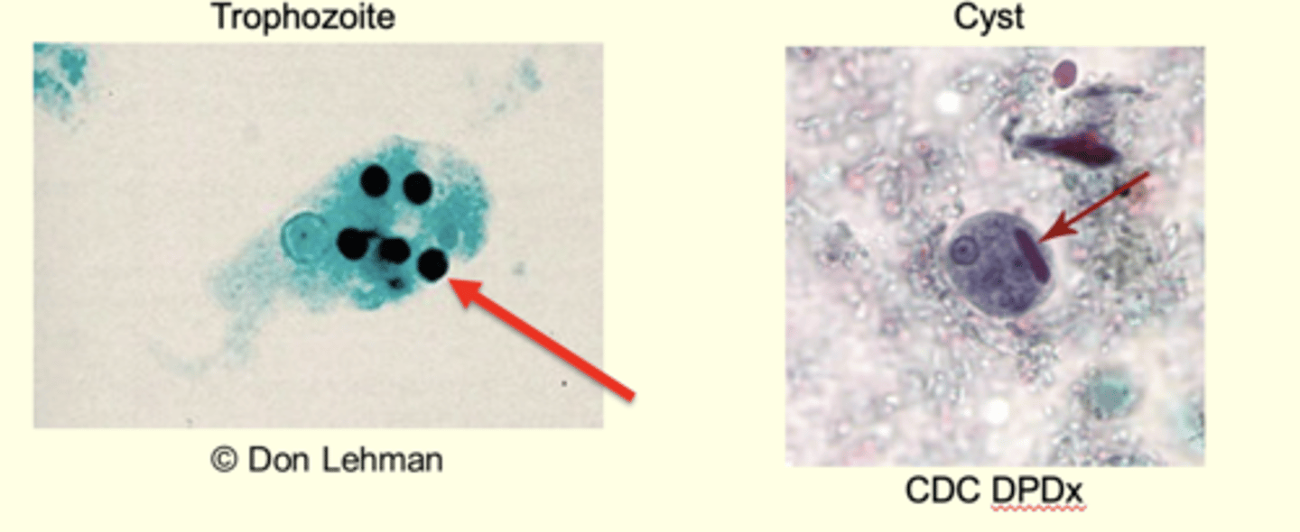 <p>Trophozoite amoeboid form in mucosa and tissues</p><p>RBCs in cytoplasm</p><p>10-20um</p><p>Explosive pseudopodia</p><p>Growth and feeding stage</p>