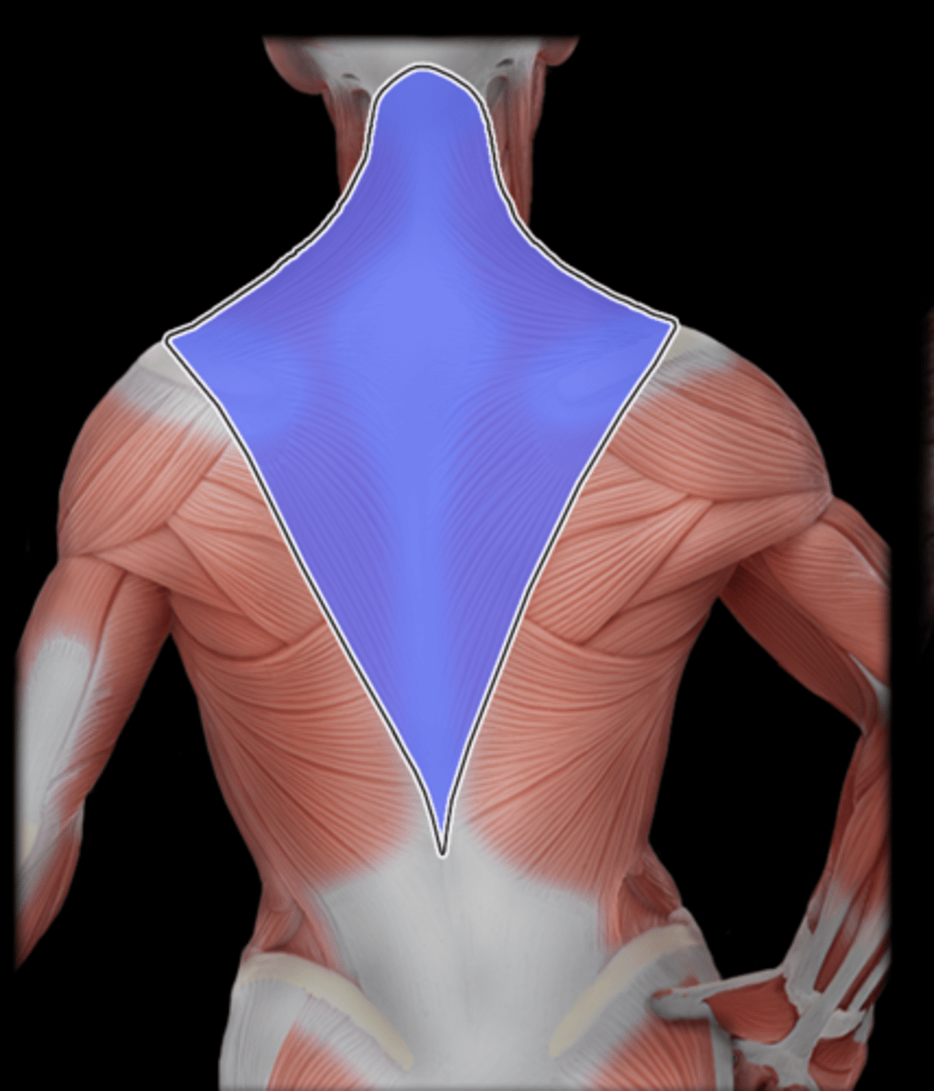 <p>What Muscle Is Highlighted?</p>