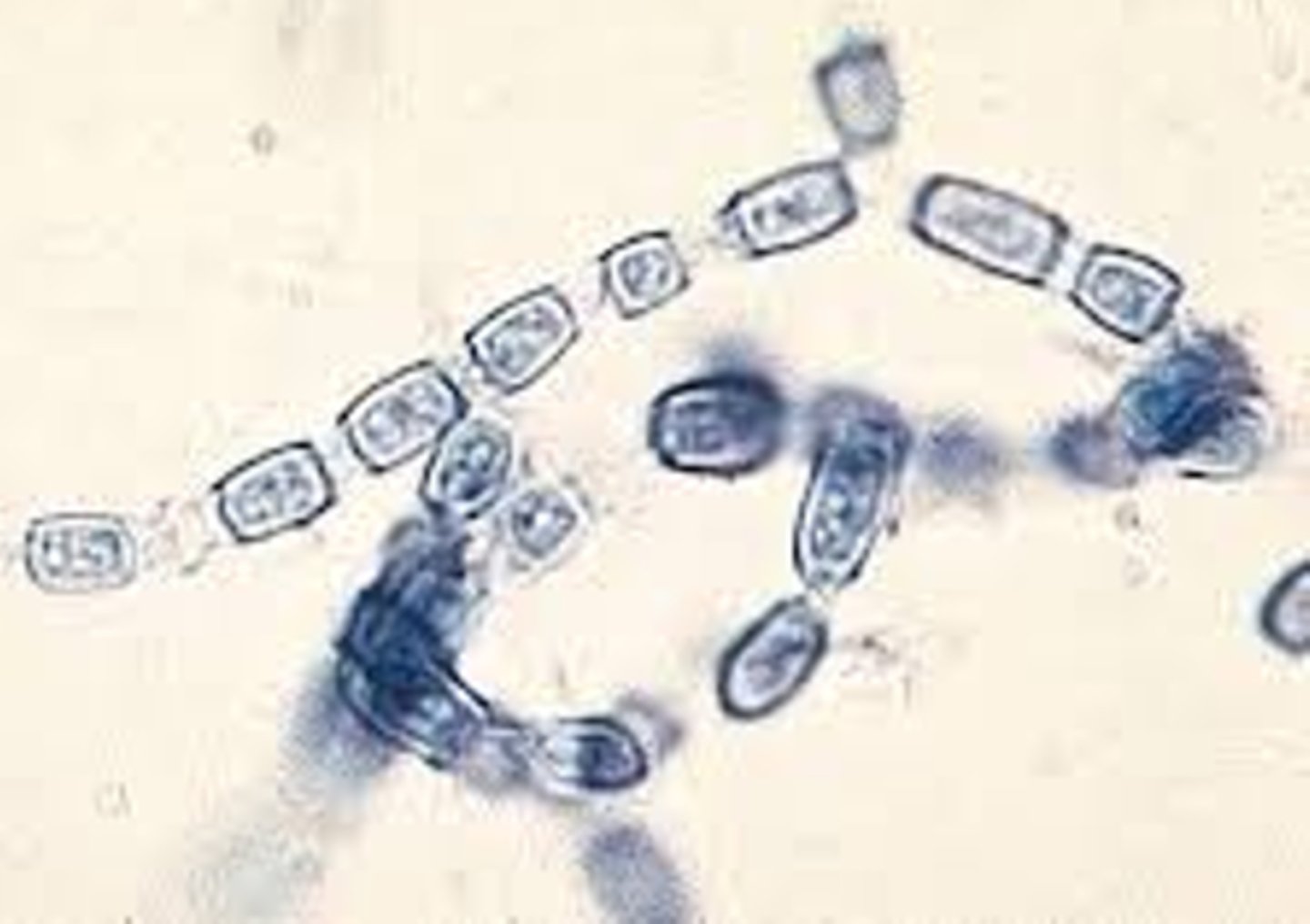 <p>oidia, disarticulation of the hyphae of mycelia, looks like train cars being pulled apart</p>