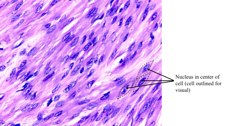 <p>What type of muscle tissue is this</p>