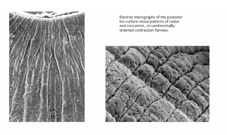 <p>posterior epithelium of iris </p>