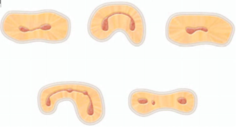 <p><span>can function as bacterial reservoirs</span></p><p><span>contains </span><span style="color: red;"><span>pulp or pulpally derived tissue</span></span></p><p><span>any root with two or more canals may have an isthmus</span></p><p><span>a narrow, ribbon-shaped communication between two root canals</span></p>