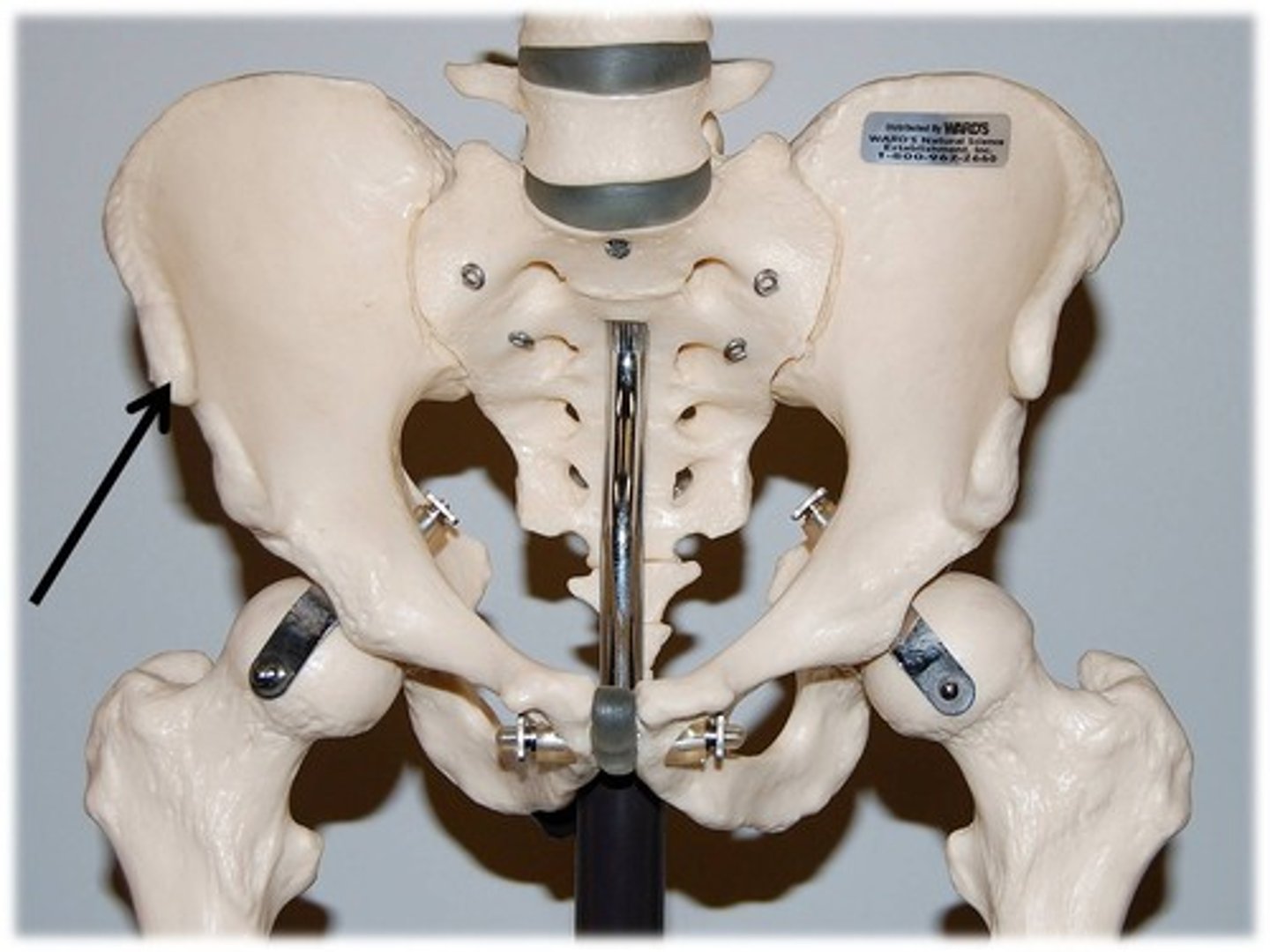 <p>Most anterior prominence of the ilium bone of the pelvis.</p><p>The attachment for the inguinal ligament and sartorius. </p>