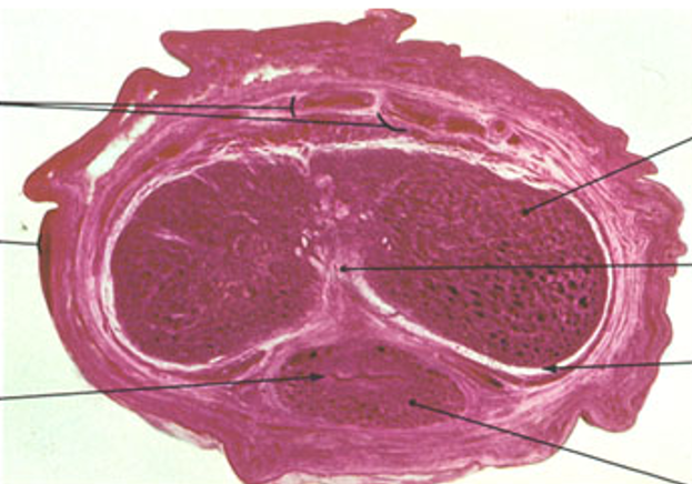 <p>Identify this structure</p>