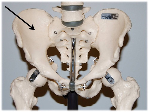 Name this specific part of the ilium.