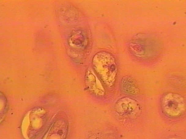 <p>Hyaline Cartalige</p>