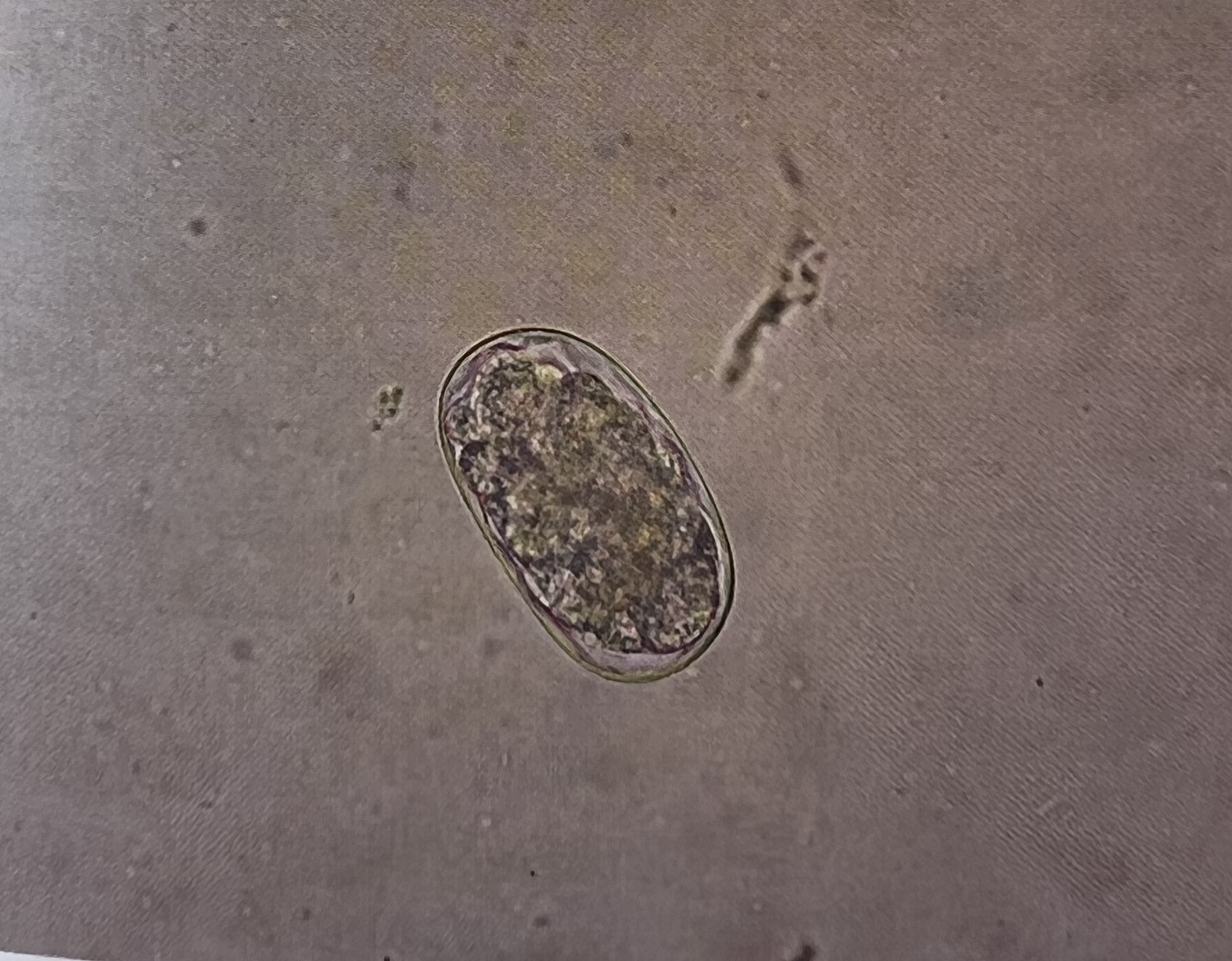 <p>What egg is this? (common name)</p>