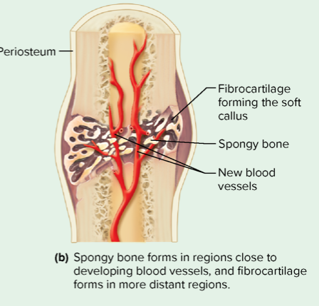 step 2 of bone repair 