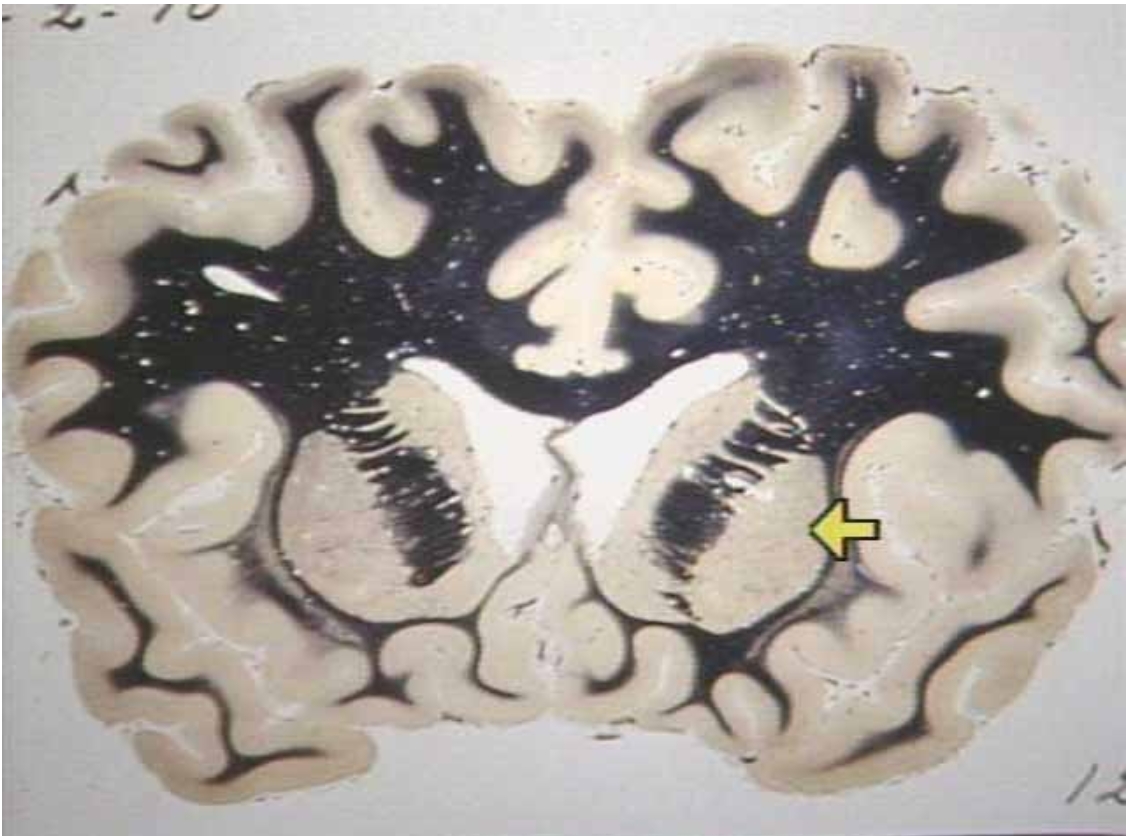 <p>What is the arrow pointing at?</p>