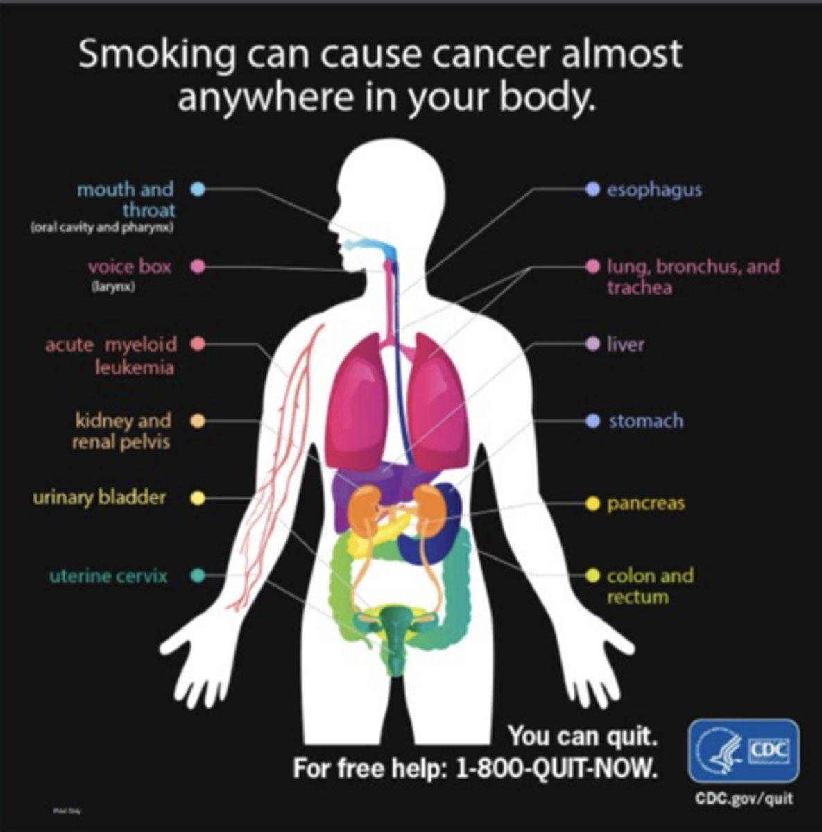 <p>FALSE</p><p>can cause cancer almost anywhere in your body</p>